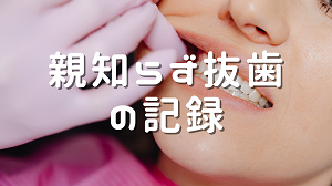 親知らず抜歯についての記録